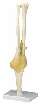 Functional Model of the Elbow Joint - Lawyers & Judges Publishing Company, Inc.