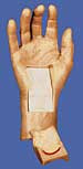 Carpal Tunnel Hand Model - Lawyers & Judges Publishing Company, Inc.