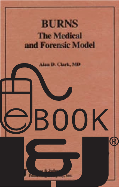 Burns: The Medical and Forensic Model PDF eBook - Lawyers & Judges Publishing Company, Inc.