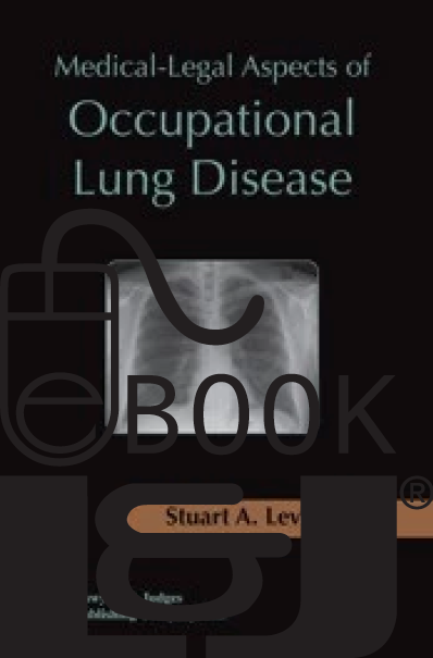 Medical Legal Aspects of Occupational Lung Disease PDF eBook - Lawyers & Judges Publishing Company, Inc.